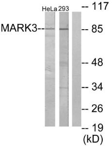 Western blot analysis of lysates from HeLa and 293 cells using Anti-MARK3 Antibody. The right hand lane represents a negative control, where the antibody is blocked by the immunising peptide