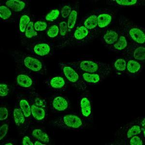 Immunofluorescent analysis of PFA fixed HeLa cells stained with Anti-Cyclin B1 Antibody [SPM619] followed by Goat Anti-Mouse IgG (CFand#174; 488) (Green)