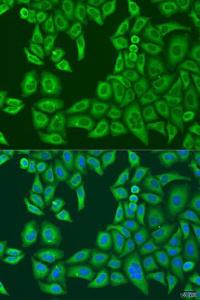 Immunofluorescence analysis of U2OS cells using Anti-ABCF2 Antibody (A11745) at a dilution of 1:100. DAPI was used to stain the cell nuclei (blue)