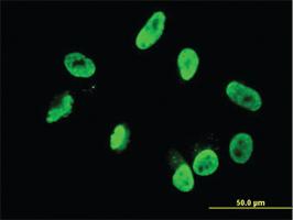 Anti-RNF168 Mouse Monoclonal Antibody [clone: 3E1]