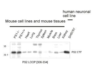 Rabbit polyclonal antibody to Presenilin 2 loop region: IgG  Western Immunoblotting of mouse and human Presenilin 2 protein in mouse cell line extracts, various mouse tissues and a human cell line. Membrane proteins were prepared and loaded as 20 µg protein per lane.