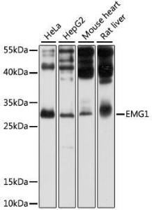 Western blot analysis of extracts of various cell lines, using Anti-EMG1 Antibody (A11749) at 1:1,000 dilution. The secondary antibody was Goat Anti-Rabbit IgG H&L Antibody (HRP) at 1:10,000 dilution.