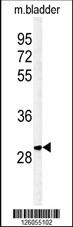 Anti-PTPLB Rabbit Polyclonal Antibody