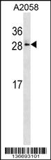 Anti-RAB28 Rabbit Polyclonal Antibody