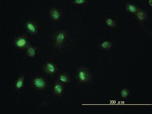 Anti-STAT5B Mouse Monoclonal Antibody [clone: 1A1]