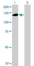 Anti-BCAN Mouse Polyclonal Antibody