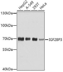 Western blot analysis of extracts of various cell lines, using Anti-IMP3 Antibody (A11751) at 1:1000 dilution. The secondary Antibody was Goat Anti-Rabbit IgG H&L Antibody (HRP) at 1:10000 dilution. Lysates/proteins were present at 25 µg per lane