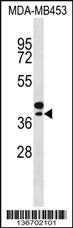 Anti-SEPP1 Rabbit Polyclonal Antibody