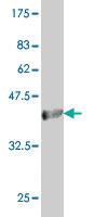 Anti-ACOX2 Mouse Monoclonal Antibody [clone: 1D1]