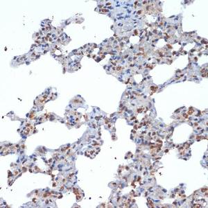 Immunohistochemistry analysis of paraffin-embedded rat lung using Anti-SOCS2 Antibody [ARC1470] (A307926) at a dilution of 1:100 (40X lens). Perform microwave antigen retrieval with 10 mM Tris/EDTA buffer pH 9.0 before commencing with IHC staining protocol