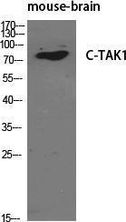 Western blot analysis of various cells using Anti-MARK3 Antibody