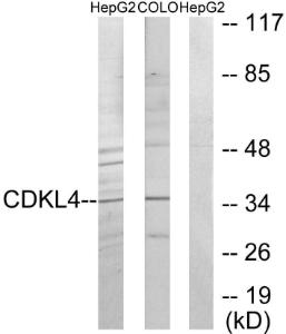 Western blot analysis of lysates from HepG2 and COLO205 cells using Anti-CDKL4 Antibody. The right hand lane represents a negative control, where the Antibody is blocked by the immunising peptide