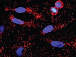 Anti-NFKB1 Antibody Pair