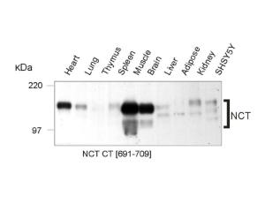 Western Immunoblotting of mouse and human Nicastrin protein in mouse tissues and a human cell line (SHSY5Y). Membrane proteins were prepared and loaded as 20 µg protein per lane.