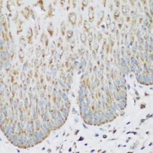 Immunohistochemistry analysis of paraffin-embedded human esophagus using Anti-IMP3 Antibody (A11751) at a dilution of 1:200 (40X lens). Perform microwave antigen retrieval with 10 mM PBS buffer pH 7.2 before commencing with IHC staining protocol