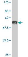 Anti-HIV1 gp120 Mouse Monoclonal Antibody [clone: 1G12]