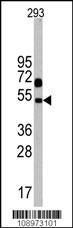 Anti-NPTX1 Rabbit Polyclonal Antibody (Biotin)