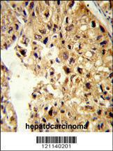 Anti-PCBD1 Rabbit Polyclonal Antibody (FITC (Fluorescein Isothiocyanate))