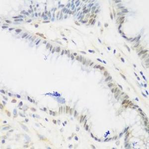 Immunohistochemistry analysis of paraffin-embedded human stomach using Anti-IMP3 Antibody (A11751) at a dilution of 1:200 (40X lens). Perform microwave antigen retrieval with 10 mM PBS buffer pH 7.2 before commencing with IHC staining protocol