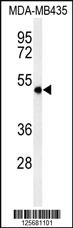 Anti-SMPDL3A Rabbit Polyclonal Antibody