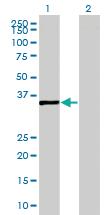 Anti-SFXN2 Mouse Polyclonal Antibody