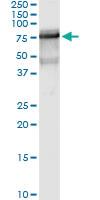 Anti-GBP2 Polyclonal Antibody Pair