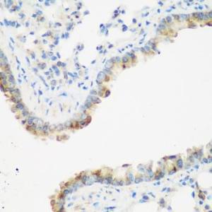 Immunohistochemistry analysis of paraffin-embedded mouse lung using Anti-IMP3 Antibody (A11751) at a dilution of 1:200 (40X lens). Perform microwave antigen retrieval with 10 mM PBS buffer pH 7.2 before commencing with IHC staining protocol