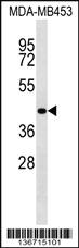 Anti-RBM4 Rabbit Polyclonal Antibody