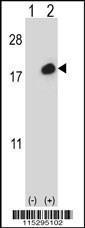 Anti-ISG15 Rabbit Polyclonal Antibody (PE (Phycoerythrin))