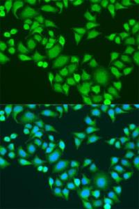 Immunofluorescence analysis of U2OS cells using Anti-IMP3 Antibody (A11751) at dilution of 100 (40X lens). DAPI was used to stain the cell nuclei (blue)