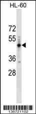 Anti-PRAMEF14 Rabbit Polyclonal Antibody