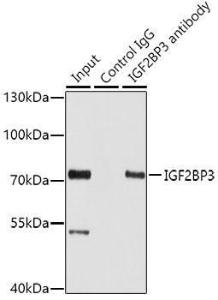 Immunoprecipitation analysis of 100 µg extracts of HepG2 cells using 3 µg of Anti-IMP3 Antibody (A11751). This Western blot was performed on the immunoprecipitate using Anti-IMP3 Antibody (A11751) at a dilution of 1:1000