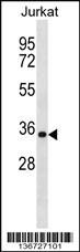 Anti-HNRNPA1 Rabbit Polyclonal Antibody