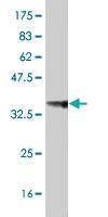 Anti-AP4E1 Mouse Polyclonal Antibody