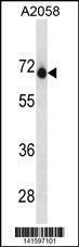 Anti-ENDOD1 Rabbit Polyclonal Antibody (HRP (Horseradish Peroxidase))