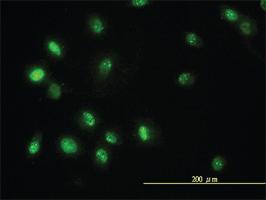 Anti-STAT5B Mouse Monoclonal Antibody [clone: 1A1]