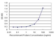 Anti-CA1 Antibody Pair