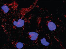 Anti-NFKB1 Antibody Pair