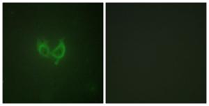 Immunofluorescence analysis of HUVEC cells using Anti-MARK2 Antibody The right hand panel represents a negative control, where the antibody was pre-incubated with the immunising peptide