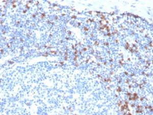 Immunohistochemical analysis of formalin-fixed, paraffin-embedded human tonsil using Anti-Integrin alpha E Antibody [ITGAE/3904R]