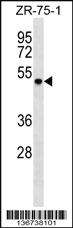 Anti-DDX6 Rabbit Polyclonal Antibody