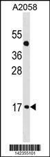 Anti-ATOH7 Rabbit Polyclonal Antibody (FITC (Fluorescein Isothiocyanate))