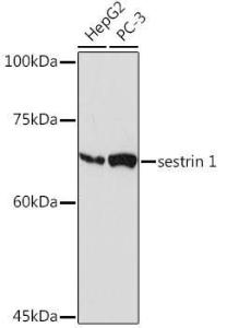 Western blot analysis of extracts of various cell lines, using Anti-SESN1 Antibody [ARC2313] (A306490) at 1:1000 dilution. The secondary Antibody was Goat Anti-Rabbit IgG H&L Antibody (HRP) at 1:10000 dilution. Lysates/proteins were present at 25 µg per lane