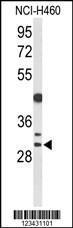 Anti-CCNB1IP1 Rabbit Polyclonal Antibody (AP (Alkaline Phosphatase))