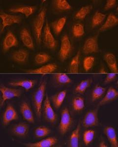 Immunofluorescence analysis of U-2 OS cells using Anti-SOCS2 Antibody [ARC1470] (A307926) at a dilution of 1:100 (40X lens). DAPI was used to stain the cell nuclei (blue)