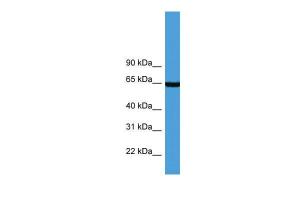 Anti-ASNS Rabbit Polyclonal Antibody