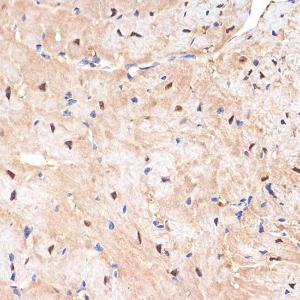 Immunohistochemistry analysis of paraffin-embedded mouse heart using Anti-SESN1 Antibody [ARC2313] (A306490) at a dilution of 1:100 (40X lens). Perform microwave antigen retrieval with 10 mM Tris/EDTA buffer pH 9.0 before commencing with IHC staining protocol