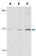 Anti-C1QTNF7 Rabbit Polyclonal Antibody