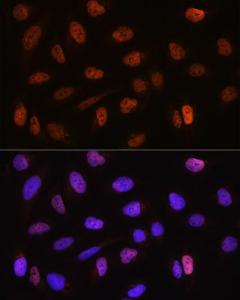 Immunofluorescence analysis of U2OS cells using Anti-CSTF2T Antibody (A11764) at a dilution of 1:100.