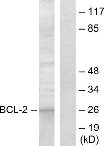 Western blot analysis of lysates from COS7 cells, treated with paclitaxel 1 µM 24 h using Anti-BCL-2 Antibody. The right hand lane represents a negative control, where the Antibody is blocked by the immunising peptide